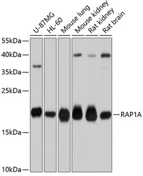 Anti-RAP1A antibody used in Western Blot (WB). GTX64554