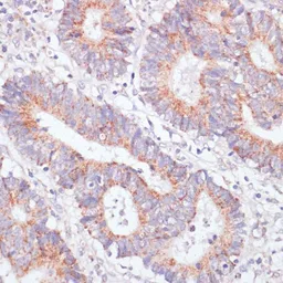 Anti-RAP1A antibody used in IHC (Paraffin sections) (IHC-P). GTX64554