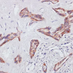 Anti-RAP1A antibody used in IHC (Paraffin sections) (IHC-P). GTX64554