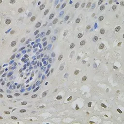 Anti-MKL1 antibody used in IHC (Paraffin sections) (IHC-P). GTX64556