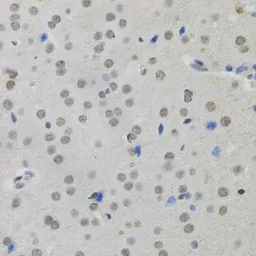 Anti-MKL1 antibody used in IHC (Paraffin sections) (IHC-P). GTX64556