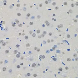 Anti-MKL1 antibody used in IHC (Paraffin sections) (IHC-P). GTX64556