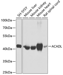 Anti-ACADL antibody used in Western Blot (WB). GTX64557