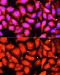 Anti-ACADL antibody used in Immunocytochemistry/ Immunofluorescence (ICC/IF). GTX64557