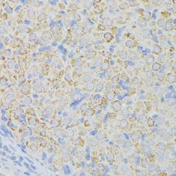 Anti-ACADL antibody used in IHC (Paraffin sections) (IHC-P). GTX64557