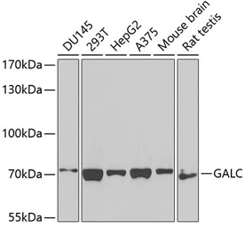 Anti-Galactosylceramidase antibody used in Western Blot (WB). GTX64559