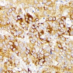 Anti-Galactosylceramidase antibody used in IHC (Paraffin sections) (IHC-P). GTX64559