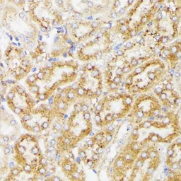 Anti-Galactosylceramidase antibody used in IHC (Paraffin sections) (IHC-P). GTX64559