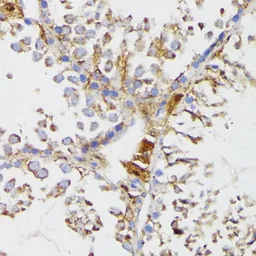 Anti-Galactosylceramidase antibody used in IHC (Paraffin sections) (IHC-P). GTX64559