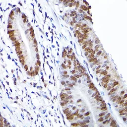 Anti-RCC1 antibody used in IHC (Paraffin sections) (IHC-P). GTX64560