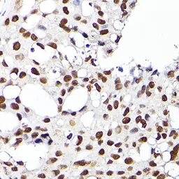 Anti-RCC1 antibody used in IHC (Paraffin sections) (IHC-P). GTX64560