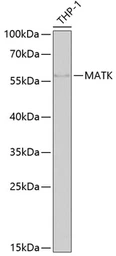 Anti-MATK antibody used in Western Blot (WB). GTX64561