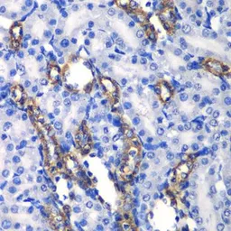 Anti-MATK antibody used in IHC (Paraffin sections) (IHC-P). GTX64561