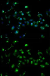 Anti-MRG15 antibody used in Immunocytochemistry/ Immunofluorescence (ICC/IF). GTX64563