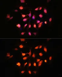 Anti-PHLPP1 antibody used in Immunocytochemistry/ Immunofluorescence (ICC/IF). GTX64568