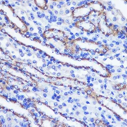 Anti-PHLPP1 antibody used in IHC (Paraffin sections) (IHC-P). GTX64568