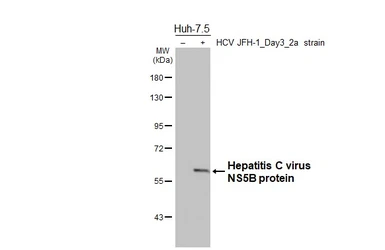 Anti-Hepatitis C virus NS5B protein antibody [HL5271] used in Western Blot (WB). GTX645709