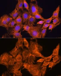Anti-AOX1 antibody used in Immunocytochemistry/ Immunofluorescence (ICC/IF). GTX64571