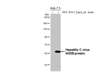 Anti-Hepatitis C virus NS5B protein antibody [HL5277] used in Western Blot (WB). GTX645715