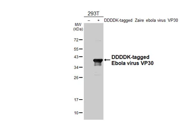 Anti-Ebola virus VP30 antibody [HL5282] used in Western Blot (WB). GTX645720
