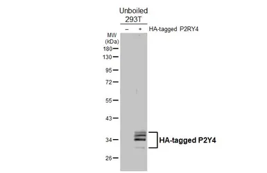 Anti-P2Y4 antibody [HL5284] used in Western Blot (WB). GTX645722