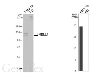 Anti-NELL1 antibody [HL5288] used in Western Blot (WB). GTX645726