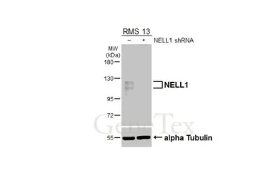 Anti-NELL1 antibody [HL5288] used in Western Blot (WB). GTX645726