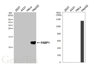 Anti-L-FABP antibody [HL5290] used in Western Blot (WB). GTX645728