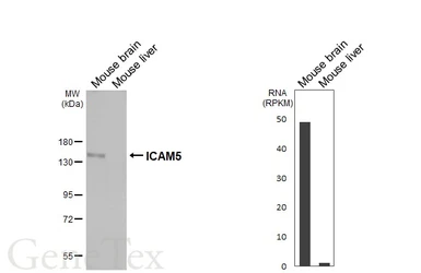 Anti-ICAM5 antibody [HL5294] used in Western Blot (WB). GTX645732