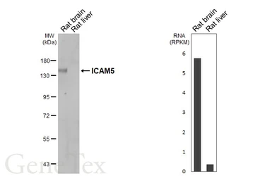 Anti-ICAM5 antibody [HL5294] used in Western Blot (WB). GTX645732