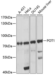Anti-POT1 antibody used in Western Blot (WB). GTX64574