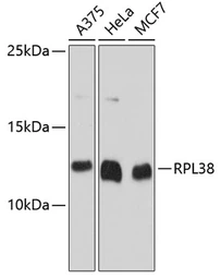 Anti-RPL38 antibody used in Western Blot (WB). GTX64575