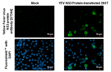 Anti-Yellow Fever virus NS3 protein antibody [GT344] used in Immunocytochemistry/ Immunofluorescence (ICC/IF). GTX645756