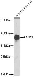Anti-FANCL antibody used in Western Blot (WB). GTX64576