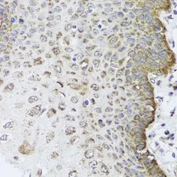 Anti-FANCL antibody used in IHC (Paraffin sections) (IHC-P). GTX64576