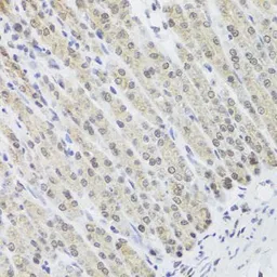 Anti-FANCL antibody used in IHC (Paraffin sections) (IHC-P). GTX64576