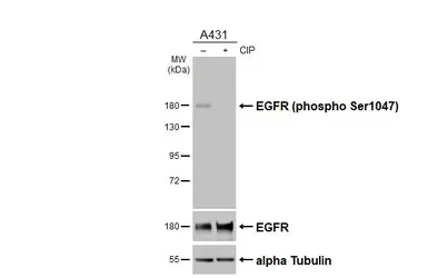 Anti-EGFR (phospho Ser1047) antibody [HL5304] used in Western Blot (WB). GTX645769
