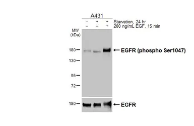 Anti-EGFR (phospho Ser1047) antibody [HL5304] used in Western Blot (WB). GTX645769