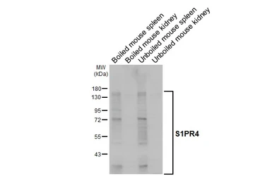 Anti-S1PR4 antibody [HL5307] used in Western Blot (WB). GTX645772