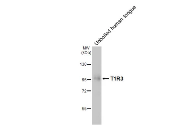 Anti-TAS1R3 antibody [HL5308] used in Western Blot (WB). GTX645773