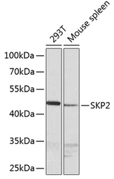 Anti-SKP2 antibody used in Western Blot (WB). GTX64578