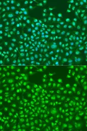 Anti-SKP2 antibody used in Immunocytochemistry/ Immunofluorescence (ICC/IF). GTX64578