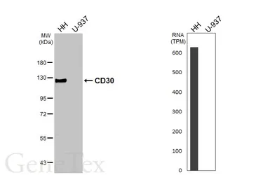 Anti-CD30 antibody [HL5323] used in Western Blot (WB). GTX645788