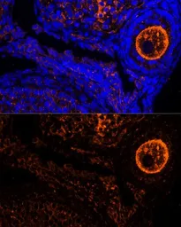 Anti-ZP2 antibody used in IHC (Paraffin sections) (IHC-P). GTX64579
