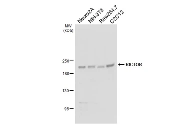 Anti-RICTOR antibody [HL5325] used in Western Blot (WB). GTX645790