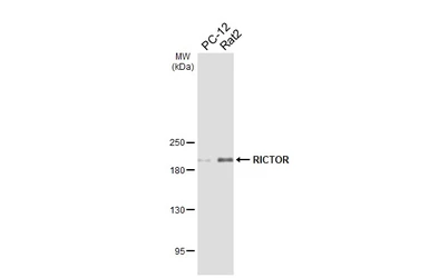 Anti-RICTOR antibody [HL5325] used in Western Blot (WB). GTX645790