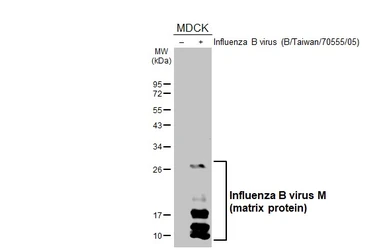 Anti-Influenza B virus M (matrix protein) antibody [HL5332] used in Western Blot (WB). GTX645810