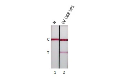 Anti-Enterovirus D68 VP1 antibody [HL5334] used in Lateral Flow (Lateral Flow). GTX645812