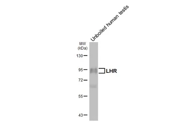 Anti-LHR antibody [HL5339] used in Western Blot (WB). GTX645817