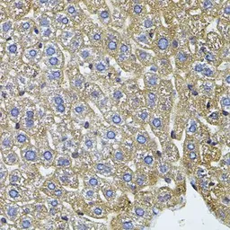 Anti-CETP antibody used in IHC (Paraffin sections) (IHC-P). GTX64582
